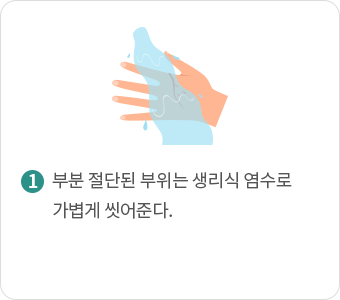 부분 절단된 부위는 생리식 염수로 가볍게 씻어준다.