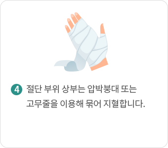 절단 부위 상부는 압박붕대 또는 고무줄을 이용해 묶어 지혈합니다.