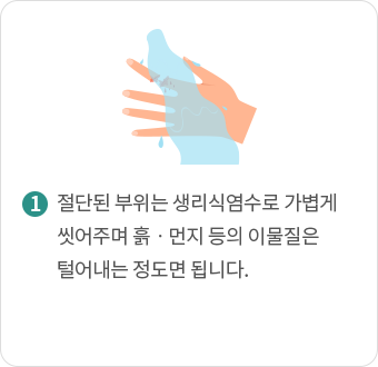 절단된 부위는 생리식염수로 가볍게 씻어주며 흙ㆍ먼지 등의 이물질은 털어내는 정도면 됩니다.