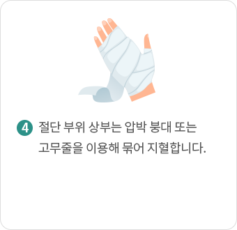 절단 부위 상부는 압박 붕대 또는 고무줄을 이용해 묶어 지혈합니다. 